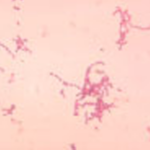 microscopic image of yoghurt